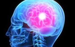 Церебральная энцефалопатия головного мозга