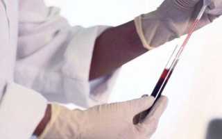 Срб анализ крови расшифровка норма у женщин