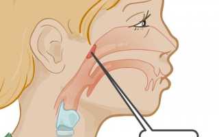 Односторонняя заложенность носа или почему не дышит одна ноздря?