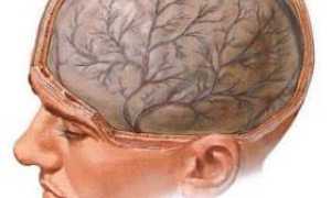 Арахноидит головного мозга симптомы и последствия